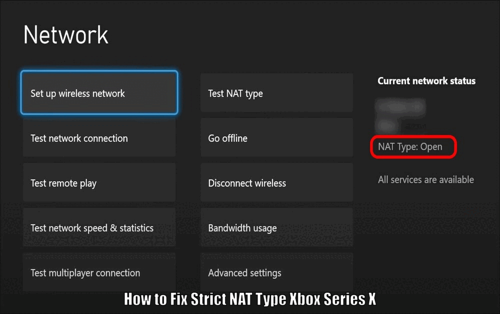 How to Fix Strict NAT Type Xbox Series X